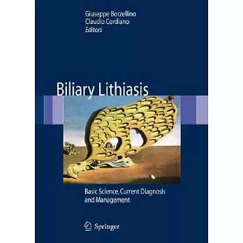 Biliary Lithiasis: Basic Science, Current Diagnosis and Management