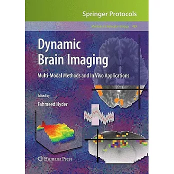 Dynamic Brain Imaging