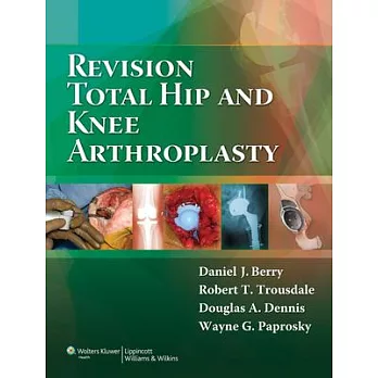 Revision Total Hip And Knee Arthroplasty