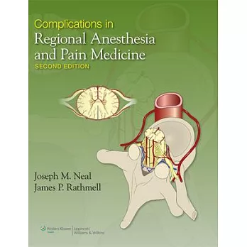 Complications in Regional Anesthesia and Pain Medicine