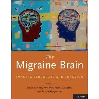 The Migraine Brain