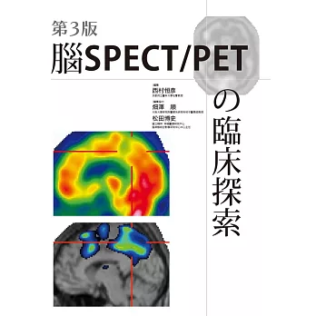 腦SPECT/PETの臨床探索(第3版)