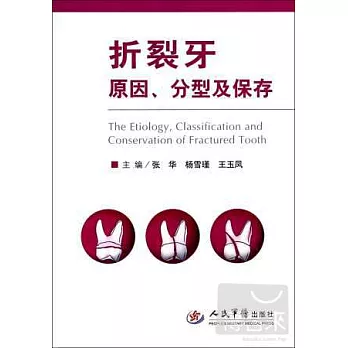 折裂牙原因、分型及保存