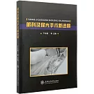 眼科及屈光手術新進展