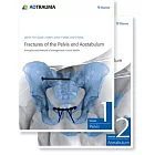 Fractures of the Pelvis and Acetabulum (Ao): Principles and Methods of Management