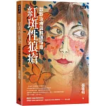 紅斑性狼瘡：診斷治療與照護指南