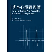 基本心電圖判讀
