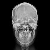 COOGIE - 2ND ALBUM [UPSET] 正規二輯 (韓國進口版)