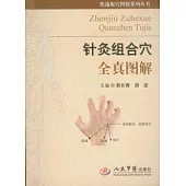 針灸組合穴全真圖解