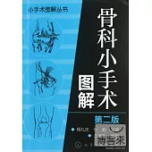小手術圖解叢書——骨科小手術圖解(第二版)
