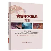 食管手術技術圖解