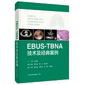 EBUS-TBNA技術及經典案例