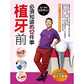 植牙前必須知道的12件事 (電子書)