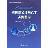 結核病X線與CT實例圖譜 (電子書)