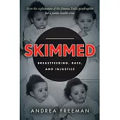 Skimmed: Breastfeeding, Race, and Injustice