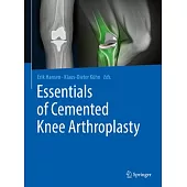 Essentials on Cemented Knee Arthroplasty
