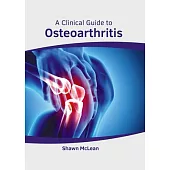 A Clinical Guide to Osteoarthritis