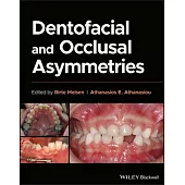 Dentofacial and Occlusal Asymmetries