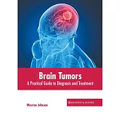 Brain Tumors: A Practical Guide to Diagnosis and Treatment