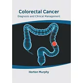 Colorectal Cancer: Diagnosis and Clinical Management