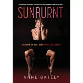 Sunburnt: A memoir of sun, surf and skin cancer