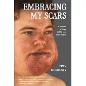 Embracing My Scars: A journey of hope in the face of adversity