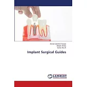 Implant Surgical Guides