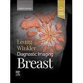 Diagnostic Imaging: Breast