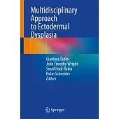 Multidisciplinary Approach to Ectodermal Dysplasia