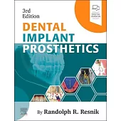 Dental Implant Prosthetics