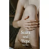 Scars and Hope