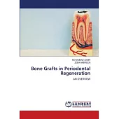 Bone Grafts in Periodontal Regeneration