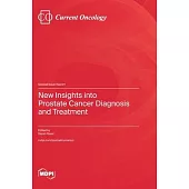 New Insights into Prostate Cancer Diagnosis and Treatment