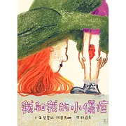 我和我的小傷疤 (電子書)
