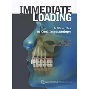 Immediate Loading: A New Era in Oral Implantology