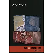 Anorexia