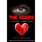 The Scars