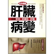 肝臟病變：認識肝炎、肝硬化、肝癌