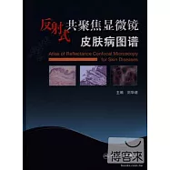 反射式共聚焦顯微鏡皮膚病圖譜