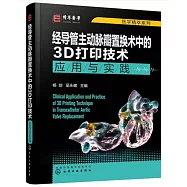 經導管主動脈瓣置換術中的3D打印技術
