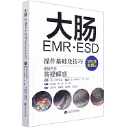 大腸EMR·ESD操作基礎及技巧(WEB視頻附)
