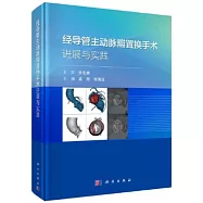 經導管主動脈瓣置換手術進展與實踐