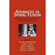 Advances in Spinal Fusion: Molecular Science, Biomechanics, and Clinical...