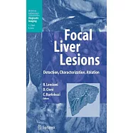 Focal Liver Lesions: Detection, Characterization, Ablation