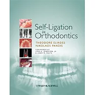 Self-Ligation in Orthodontics: An Evidence-Based Approach to Biomechanics and Treatment