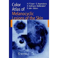 Color Atlas of Melanocytic Lesions of the Skin