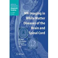 Mr Imaging In White Matter Diseases Of The Brain And Spinal Cord
