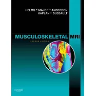 Musculoskeletal MRI