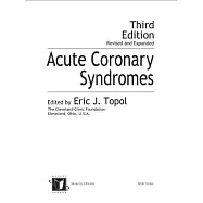 Acute Coronary Syndromes