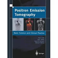 Positron Emission Tomography